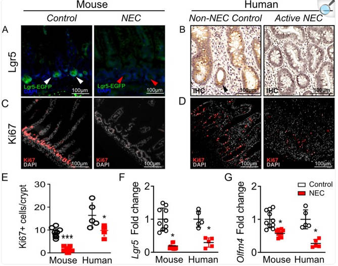 Impaired Wnt β-catenin pathway leads to dysfunction of intestinal regeneration during necrotizing enterocolitis