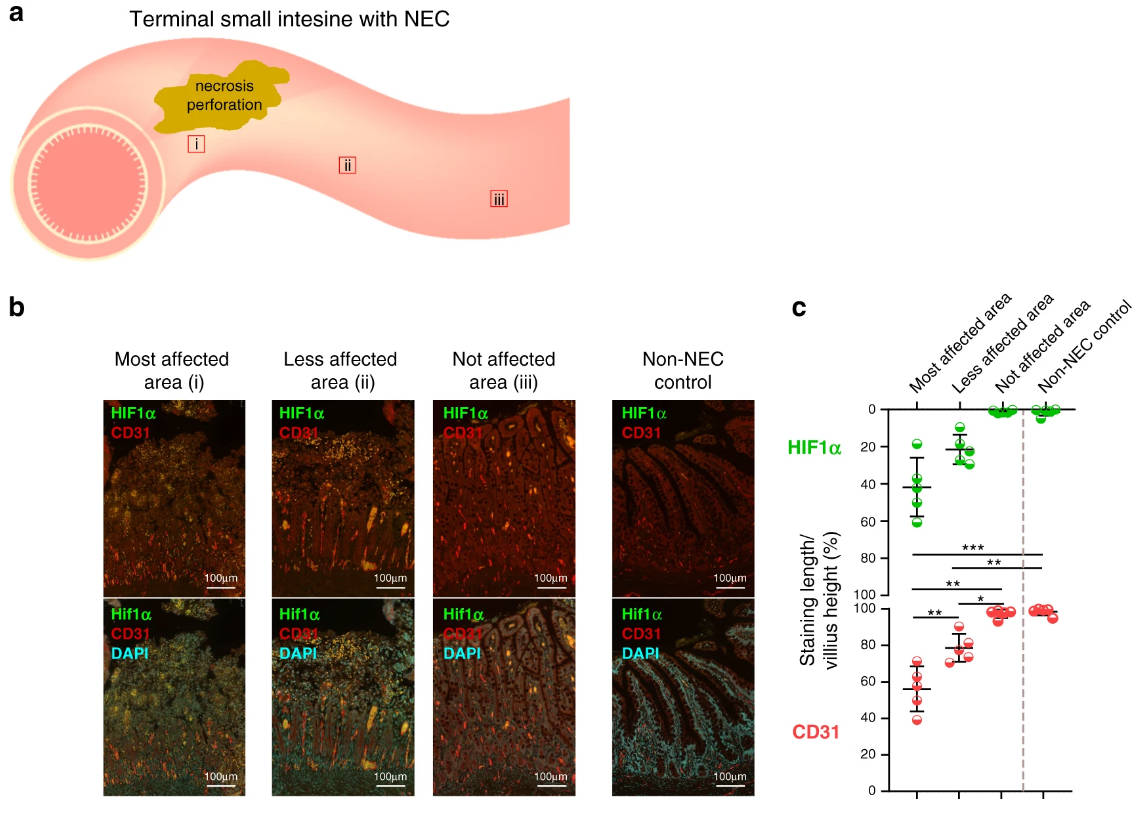 Remote ischemic conditioning counteracts the intestinal damage of necrotizing enterocolitis by improving intestinal microcirculation